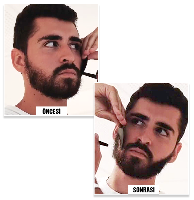  before and after using Bunee