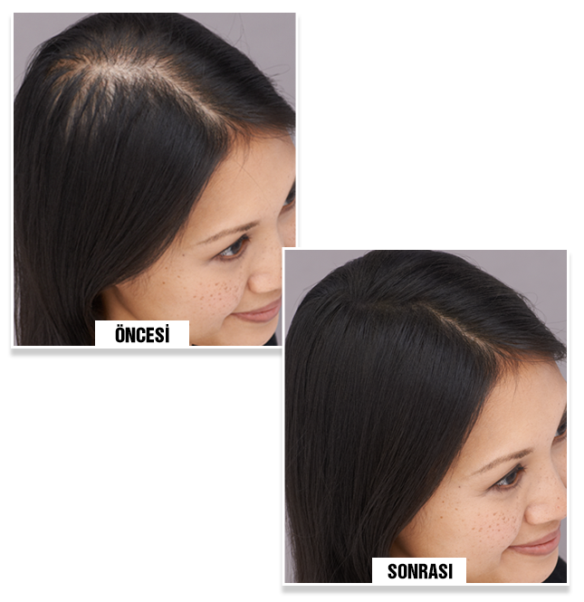 Hazel P. before and after using Bunee