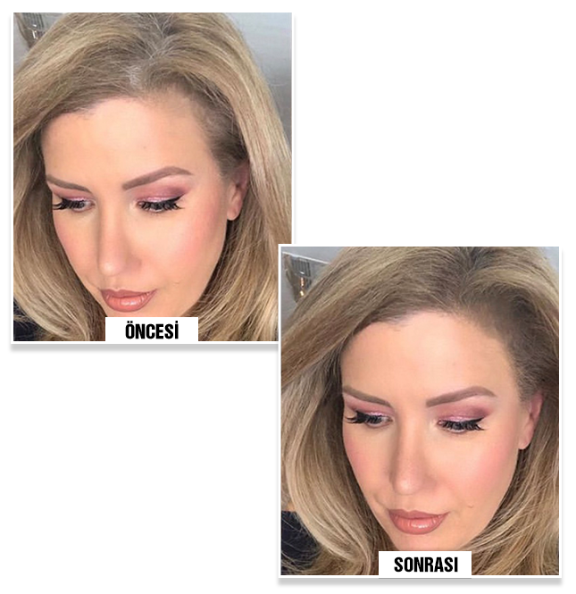  before and after using Bunee