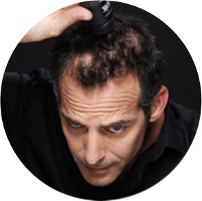 Applying product to bald patch